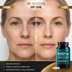 NAD+ & RESVERATROL®
